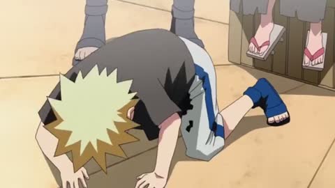 EP-315