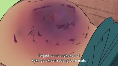 EP 81