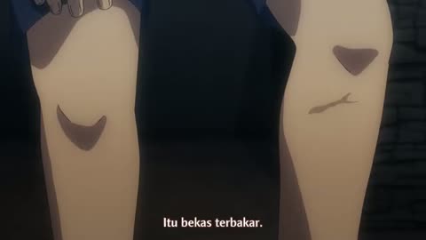 EP-17
